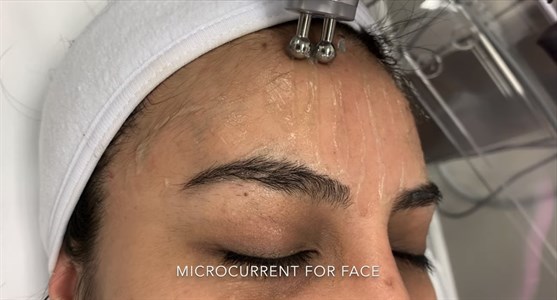 MicroCurrent Facial Package Special Photo